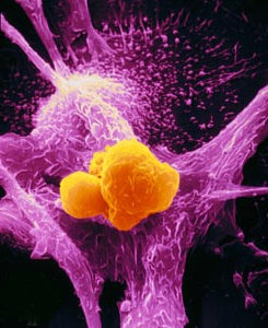 A macrophage (purple) attacks a cancer cell (yellow) A macrophage (purple) attacks a cancer cell (yellow)