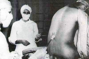 A spinal tap administered as part of the Tuskegee Syphilis Study